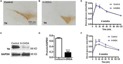 Downregulated Dopamine Receptor 2 and Upregulated Corticotrophin Releasing Hormone in the Paraventricular Nucleus Are Correlated With Decreased Glucose Tolerance in Rats With Bilateral Substantia Nigra Lesions